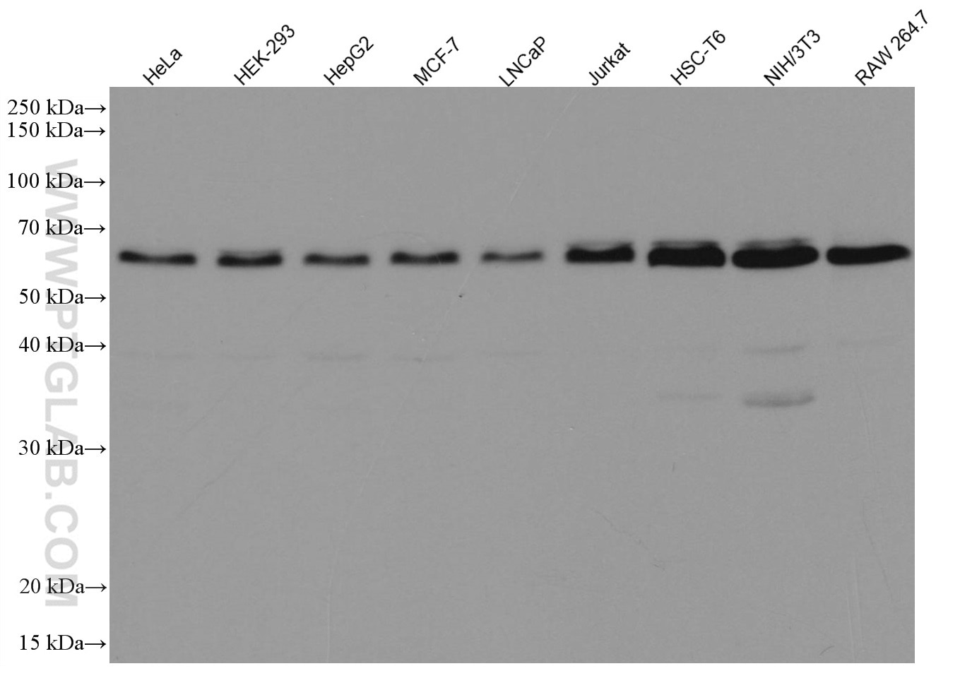 Various lysates were subjected to SDS PAGE followed by western blot with 66665-1-Ig (Beclin 1 antibody) at dilution of 1:10000 incubated at room temperature for 1.5 hours.