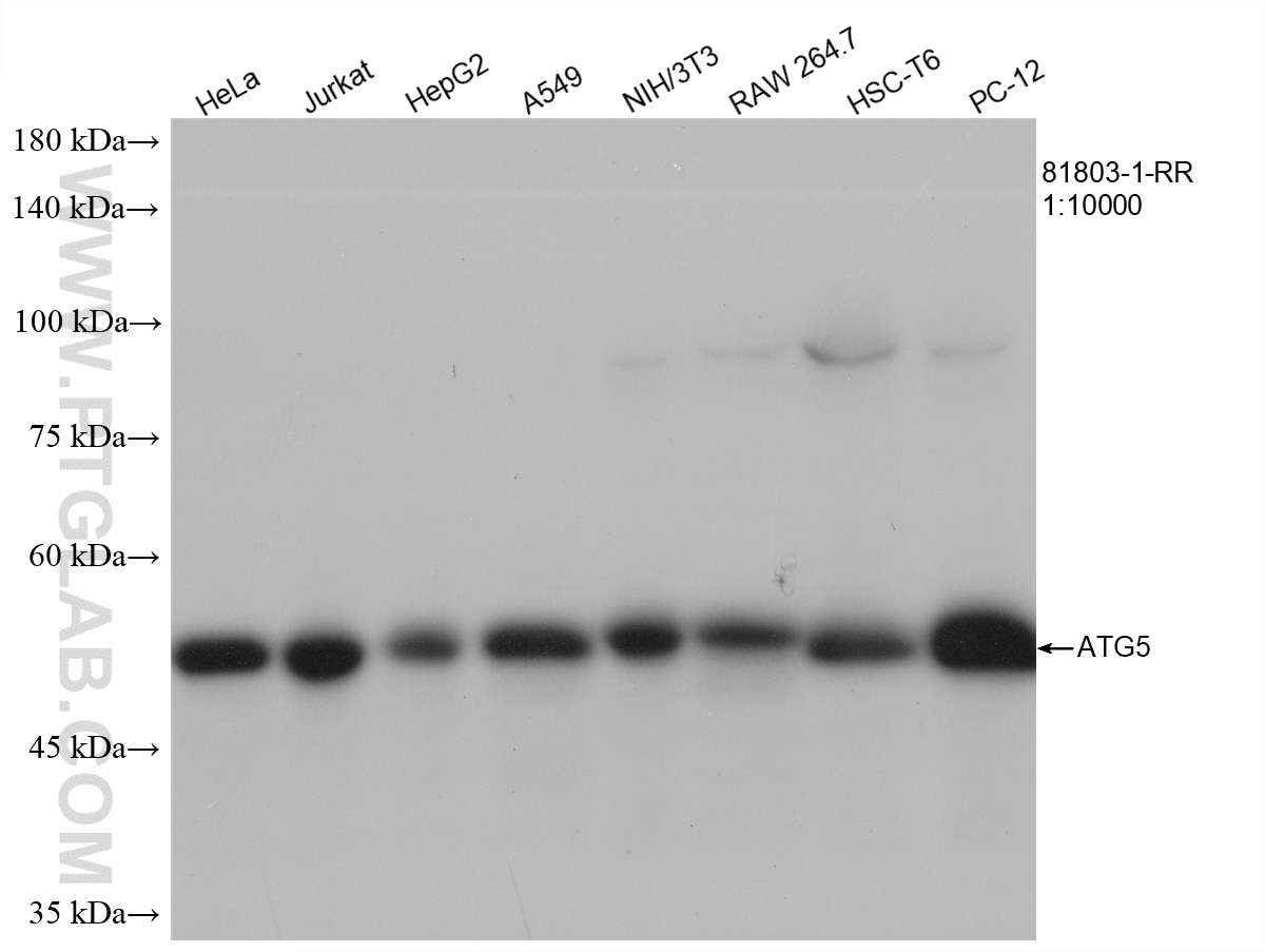 Various lysates were subjected to SDS PAGE followed by western blot with 81803-1-RR (ATG5 antibody) at dilution of 1:10000 incubated at room temperature for 1.5 hours.