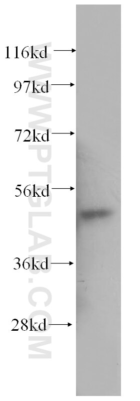 human bladder tissue were subjected to SDS PAGE followed by western blot with 11122-1-AP (ATG12 antibody) at dilution of 1:500  incubated at room temperature for 1.5 hours.