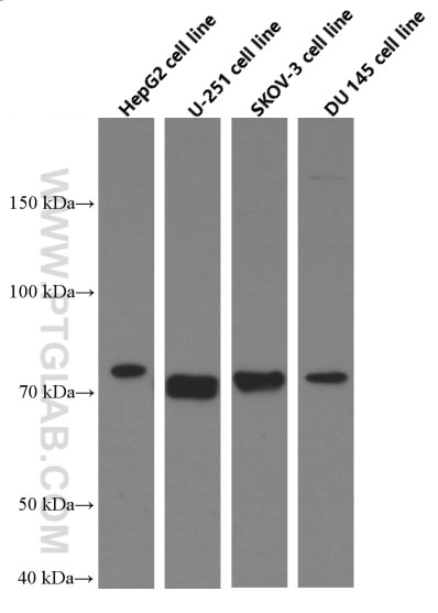 Western blot analysis of MMP2 in various cell lines using Proteintech antibody 66366-1-Ig (MMP2 Antibody) at dilution of 1:3000  incubated at room temperature for 1.5 hours.