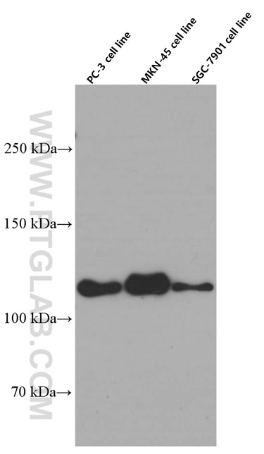 PC-3, MKN-45, SGC-7901 cells were subjected to SDS PAGE followed by western blot with 60335-1-Ig (E-cadherin Antibody) at dilution of 1:4000  incubated at room temperature for 1.5 hours.