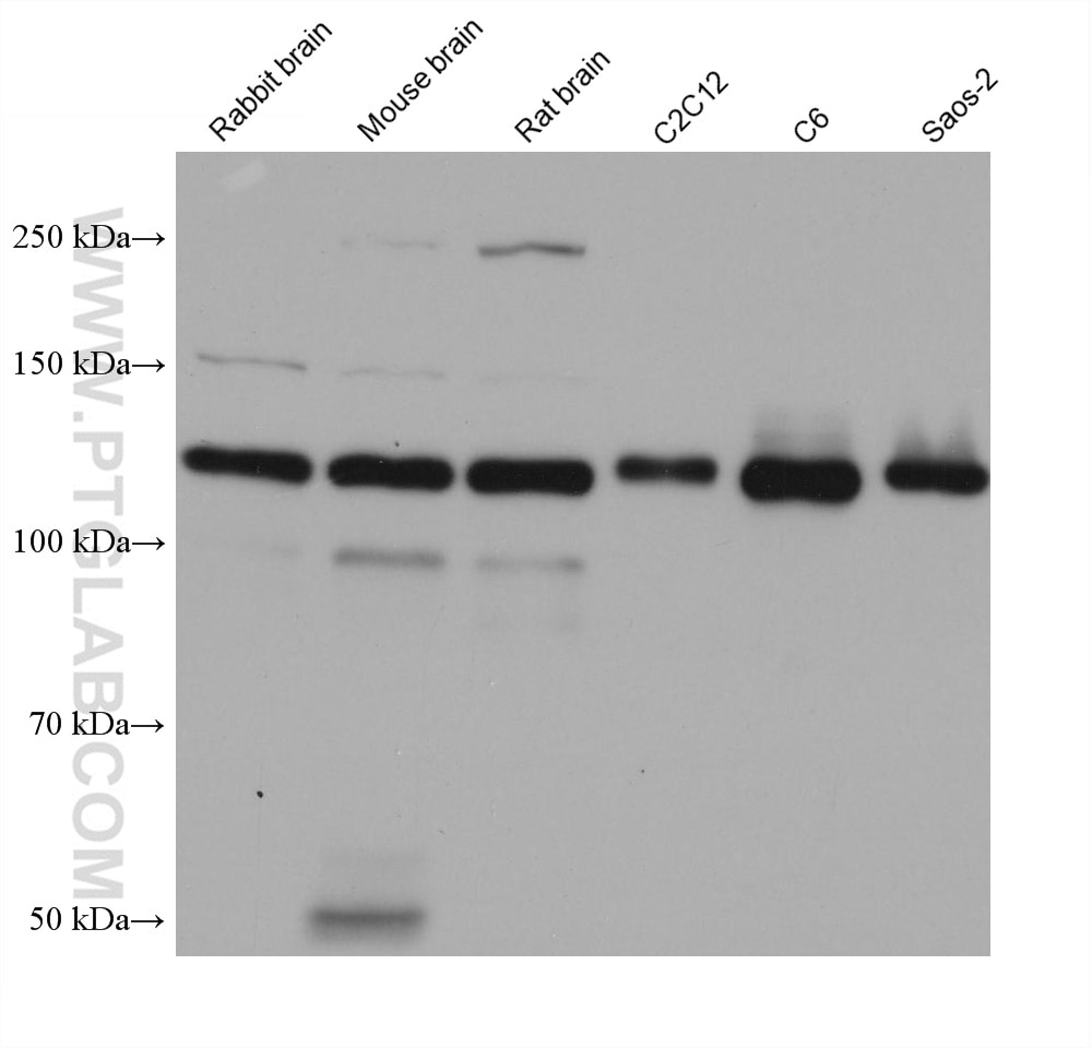 Various lysates were subjected to SDS PAGE followed by western blot with 66219-1-Ig (N-cadherin antibody) at dilution of 1:20000 incubated at room temperature for 1.5 hours.