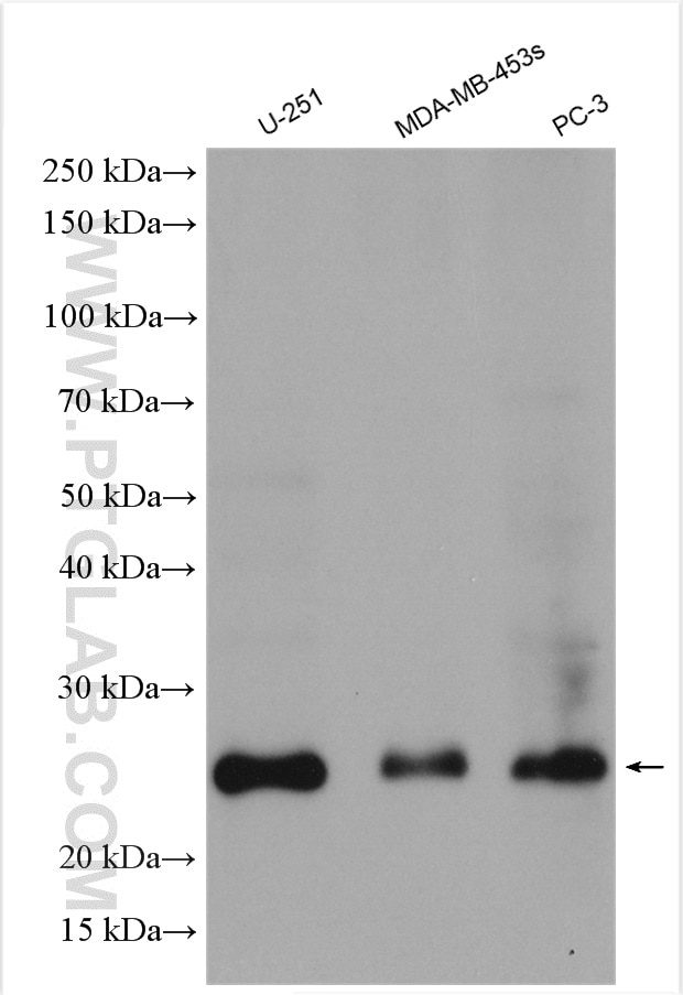 Various lysates were subjected to SDS PAGE followed by western blot with 25465-1-AP (TWIST1-specific antibody) at dilution of 1:2000 incubated at room temperature for 1.5 hours.