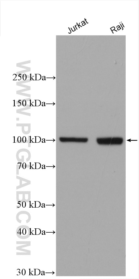 Various lysates were subjected to SDS PAGE followed by western blot with 10375-2-AP (MMP9 (N-terminal) antibody) at dilution of 1:1500 incubated at room temperature for 1.5 hours.