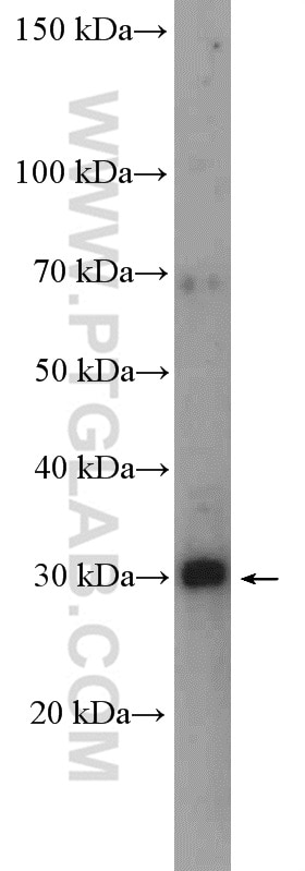  HeLa cells were subjected to SDS PAGE followed by western blot with 16690-1-AP (ALY antibody) at dilution of 1:600  incubated at room temperature for 1.5 hours.