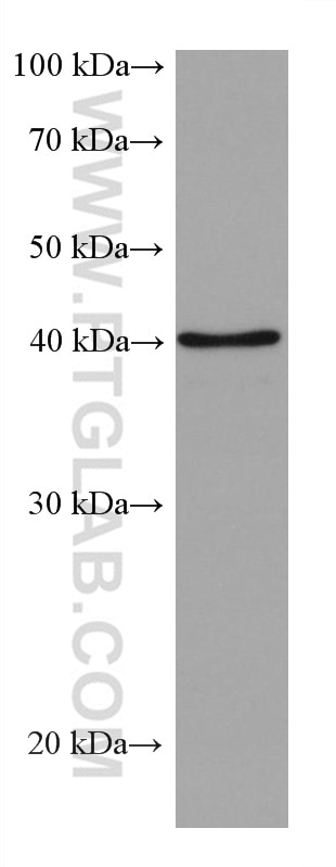 4T1 cells were subjected to SDS PAGE followed by western blot with 67811-1-Ig (ALKBH5 antibody) at dilution of 1:10000 incubated at room temperature for 1.5 hours.