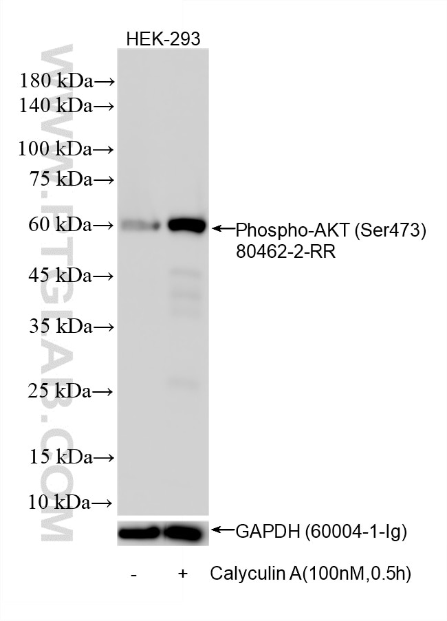 Non-treated and Calyculin A treated HEK-293 cells were subjected to SDS PAGE followed by western blot with 80462-2-RR (Phospho-AKT (Ser473) antibody) at dilution of 1:2000 incubated at room temperature for 1.5 hours. The membrane was stripped and re-blotted with GAPDH antibody (60004-1-Ig) as loading control. Non-treated and Calyculin A treated HEK-293 cells were subjected to SDS PAGE followed by western blot with 80462-2-RR (Phospho-AKT (Ser473) antibody) at dilution of 1:2000 incubated at room temperature for 1.5 hours. The membrane was stripped and re-blotted with GAPDH antibody (60004-1-Ig) as loading control.
