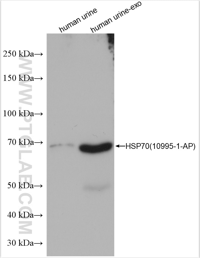 Human urine and human urine-derived exosomes (human urine-exo)  were subjected to SDS PAGE followed by western blot with 10995-1-AP (HSP70 antibody) at dilution of 1:10000 incubated at room temperature for 1.5 hours.