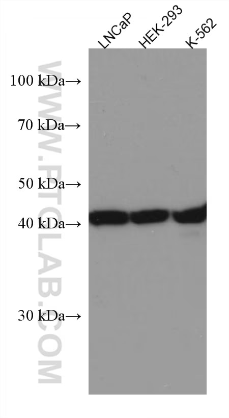 Various lysates were subjected to SDS PAGE followed by western blot with 67298-1-Ig (LIAS antibody) at dilution of 1:3000 incubated at room temperature for 1.5 hours.