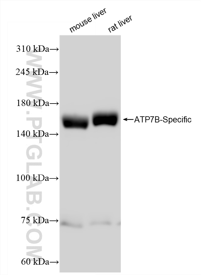 Various lysates were subjected to SDS PAGE followed by western blot with 85288-2-RR (ATP7B-Specific antibody) at dilution of 1:10000 incubated at room temperature for 1.5 hours.