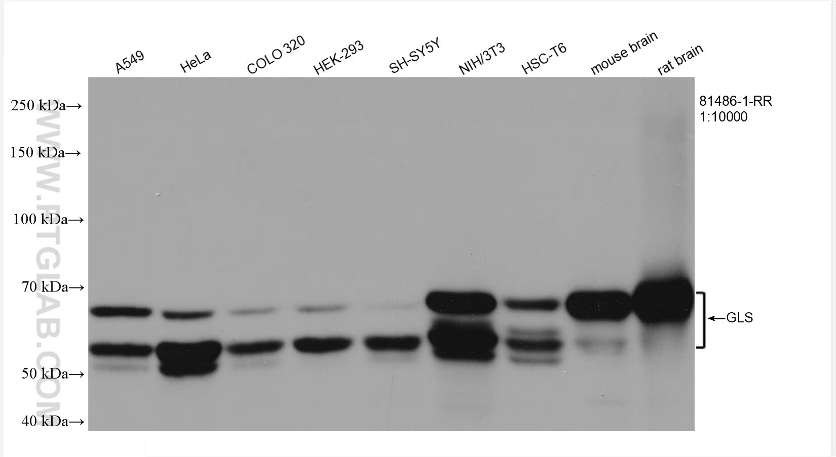 Various lysates were subjected to SDS PAGE followed by western blot with 81486-1-RR (GLS antibody) at dilution of 1:10000 incubated at room temperature for 1.5 hours.