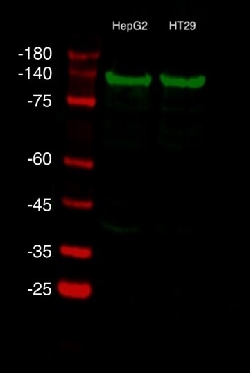 HepG2 and HT29 lysates were subjected to SDS PAGE followed by western blot using ChemBright CoraLite® Plus 488 Antibody Conjugation Kit (PK30030) conjugated TOM20 Polyclonal antibody (11802-1-AP) at dilution of 1:1000 incubated at room temperature for 1.5 hours HepG2 and HT29 lysates were subjected to SDS PAGE followed by western blot using ChemBright CoraLite® Plus 488 Antibody Conjugation Kit (PK30030) conjugated TOM20 Polyclonal antibody (11802-1-AP) at dilution of 1:1000 incubated at room temperature for 1.5 hours