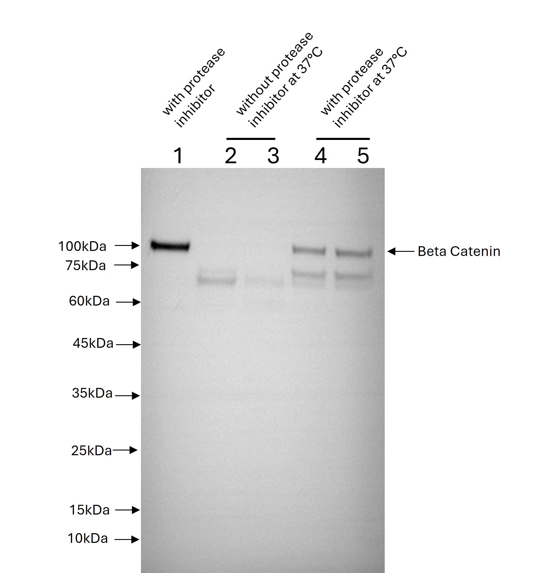 HeLa cells were lysed using RIPA Buffer (PR20135) with and without protease inhibitor cocktail (PR20032). Cell lysates without (lane 2 and 3) and with (lane 1, 4 and 5) the protease inhibitor cocktail were either incubated at 37°C for 4 hours (lanes 2 and 4) or 4°C for 21 hours (lanes 3 and 5). Lysate used for lane 1 did not undergo prolonged incubation. Following this incubation lysates were subjected to SDS-PAGE (5 ug protein/well) followed by western blot with anti-Beta Catenin (51067-2-AP). HeLa cells were lysed using RIPA Buffer (PR20135) with and without protease inhibitor cocktail (PR20032). Cell lysates without (lane 2 and 3) and with (lane 1, 4 and 5) the protease inhibitor cocktail were either incubated at 37°C for 4 hours (lanes 2 and 4) or 4°C for 21 hours (lanes 3 and 5). Lysate used for lane 1 did not undergo prolonged incubation. Following this incubation lysates were subjected to SDS-PAGE (5 ug protein/well) followed by western blot with anti-Beta Catenin (51067-2-AP).