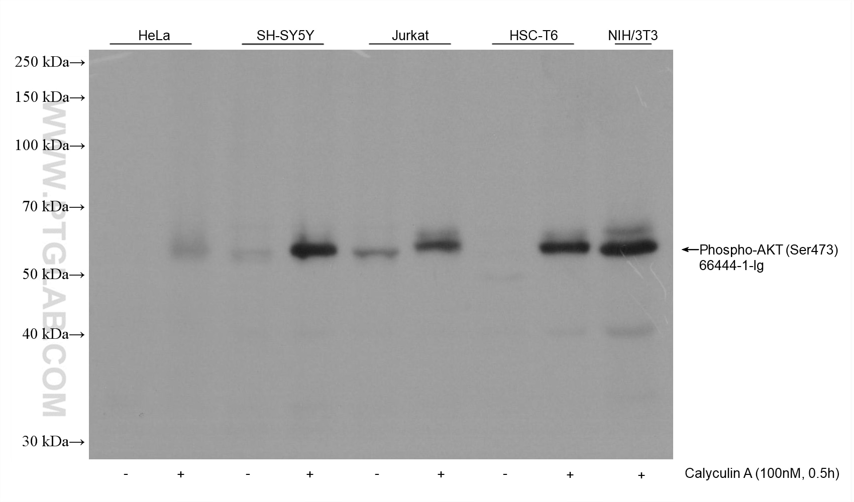 Various samples were loaded at 30 ug per well and subjected to Western blot, unblocked. Primary antibody 66444-1-Ig (Phospho-AKT (Ser473) Mouse Monoclonal Antibody) was diluted with PR20039 at 1:10,000 and incubated at room temperature for 15 minutes. The secondary antibody RGAM001 was diluted with PR20039 at 1:20,000 and incubated at room temperature for 10 minutes.