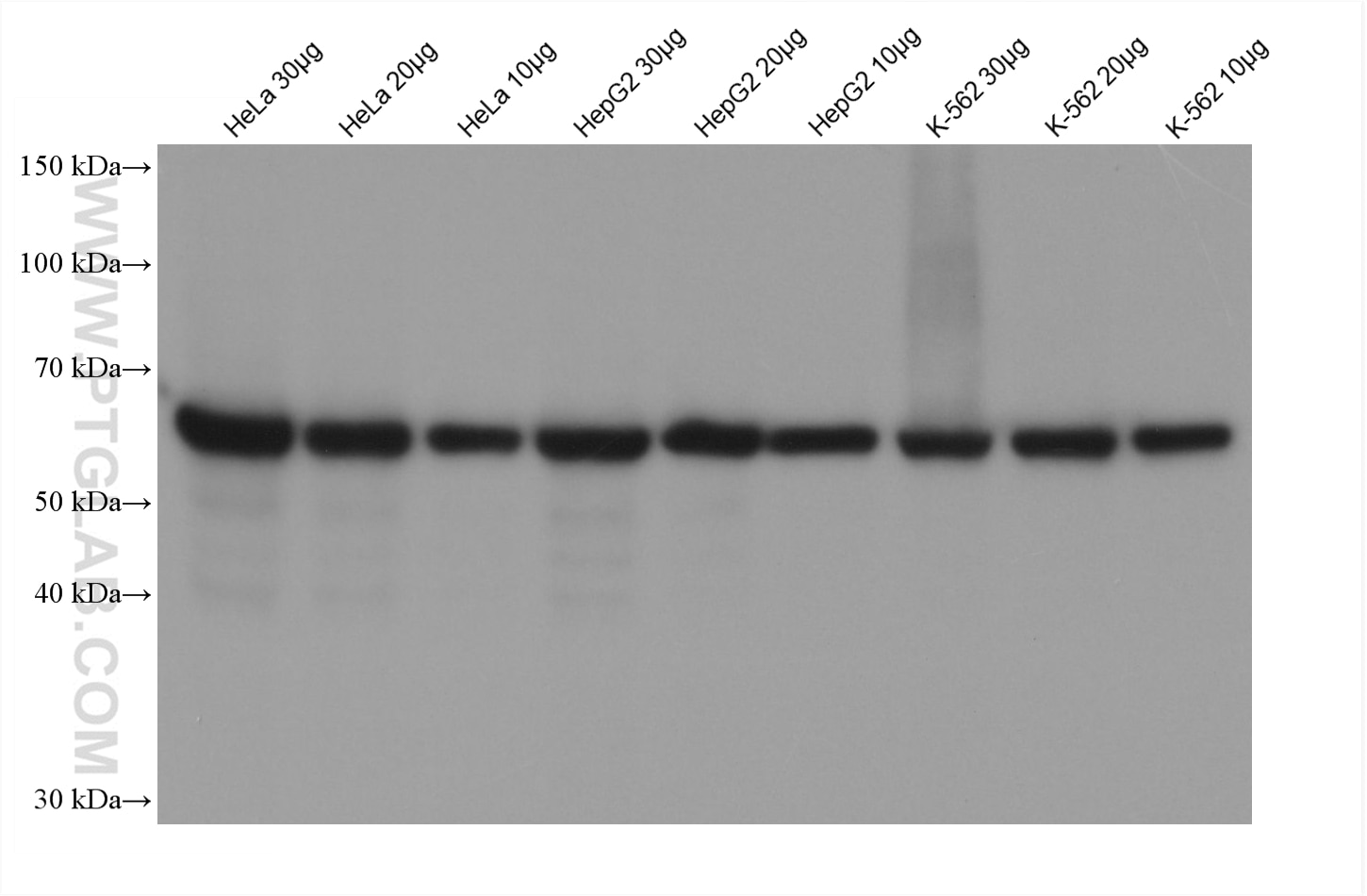 Various samples were loaded at different volumes per well and subjected to Western blot, unblocked. Primary antibody 15282-1-AP (HSPD1 Rabbit Polyclonal Antibody) was diluted with PR20039 at 1:50,000 and incubated at room temperature for 18 minutes. The secondary antibody RGAR001 was diluted with PR20039 at 1:20,000 and incubated at room temperature for 8 minutes.