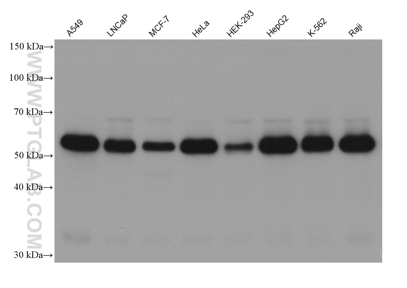 Various samples were loaded at 30 ug per well and subjected to Western blot, unblocked. Primary antibody 66184-1-Ig (p62 Mouse Monoclonal Antibody) was diluted with PR20039 at 1:20,000 and incubated at room temperature for 15 minutes. The secondary antibody RGAM001 was diluted with PR20039 at 1:20,000 and incubated at room temperature for 10 minutes.