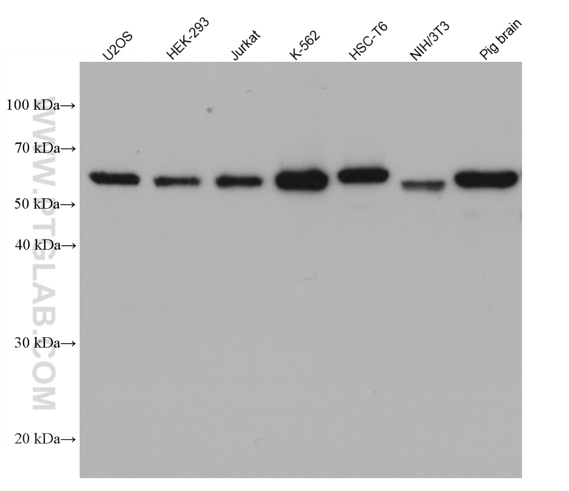 Various lysates were subjected to SDS-PAGE followed by western blot with Catalase mouse monoclonal antibody (66765-1-Ig) at 1:10000.  Multi-rAb HRP-Goat Anti-Mouse Recombinant Secondary Antibody (H+L) RGAM001 were used at 1:20000 for detection. 
