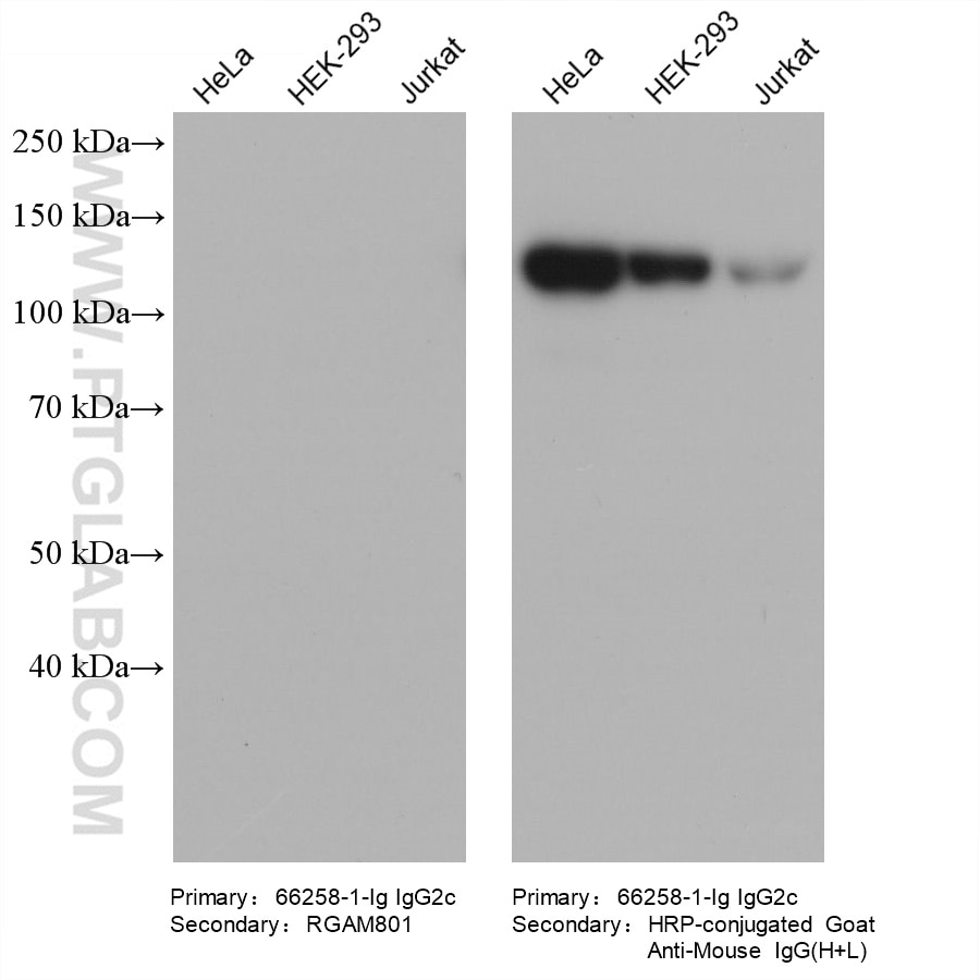 Various lysates were subjected to SDS-PAGE followed by western blot with FAK mouse monoclonal antibody (66258-1-Ig, IgG2c).  HRP-Goat Anti-Mouse IgA-Specific Recombinant Secondary Antibody (RGAM801) and Multi-rAb HRP-Goat Anti-Mouse IgG (H+L) Recombinant Secondary Antibody (RGAM001) were used at 1: 20000 for detection.  The result shows that RGAM801 does not react with mouse IgG2c.