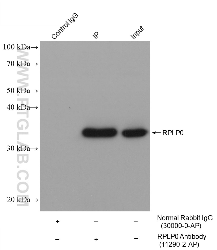 IP-WB detection with RGAR301.
Lysate: HeLa cells;
IP Primary: RPLP0, 11290-2-AP;
IP Control: Rabbit IgG, 30000-1-AP;
SDS-PAGE loading amount: 20% of IP elution and 30 μg total protein for input;
WB Primary: RPLP0, 11290-2-AP, 1:8000;
WB secondary: RGAR301, 1:2500.