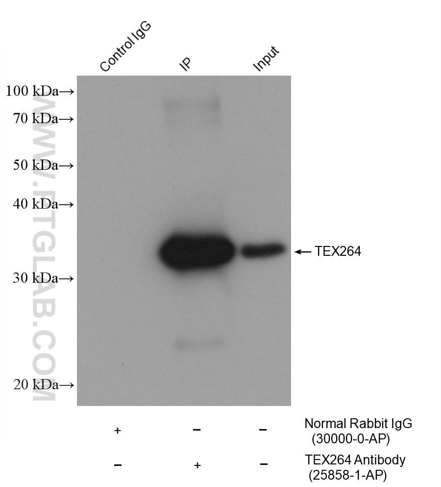 IP-WB detection with RGAR301.
Lysate: HEK-293 cells;
IP Primary: TEX264, 25858-1-AP;
IP Control: Rabbit IgG, 30000-1-AP;
SDS-PAGE loading amount: 20% of IP elution and 30 μg total protein for input;
WB Primary: TEX264, 25858-1-AP, 1:3000;
WB secondary: RGAR301, 1:2500.