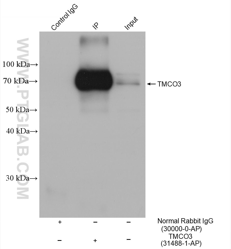 IP-WB detection with RGAR301.
Lysate: HepG2 cells;
IP Primary: TMCO3, 31488-1-AP;
IP Control: Rabbit IgG, 30000-1-AP;
SDS-PAGE loading amount: 20% of IP elution and 30 μg total protein for input;
WB Primary: TMCO3, 31488-1-AP, 1:1000;
WB secondary: RGAR301, 1:2500.