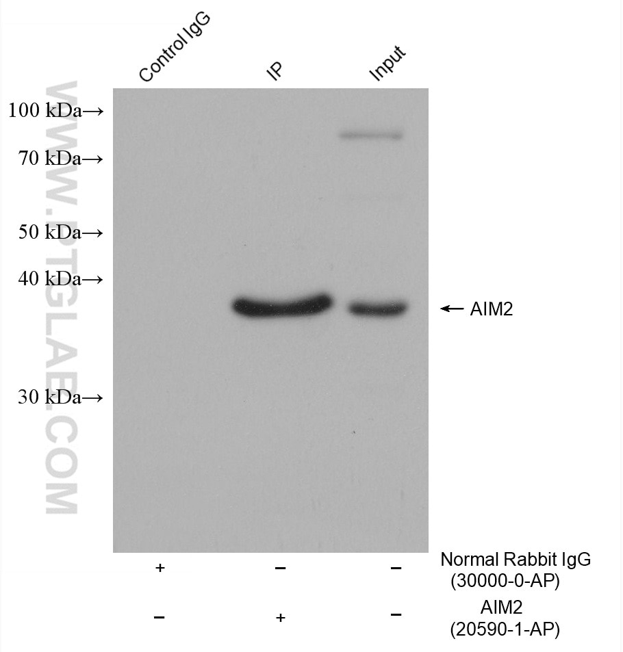 IP-WB detection with RGAR301.
Lysate: Raji cells;
IP Primary: AIM2, 25090-1-AP;
IP Control: Rabbit IgG, 30000-1-AP;
SDS-PAGE loading amount: 20% of IP elution and 30 μg total protein for input;
WB Primary: AIM2, 25090-1-AP, 1:600;
WB secondary: RGAR301, 1:2500.