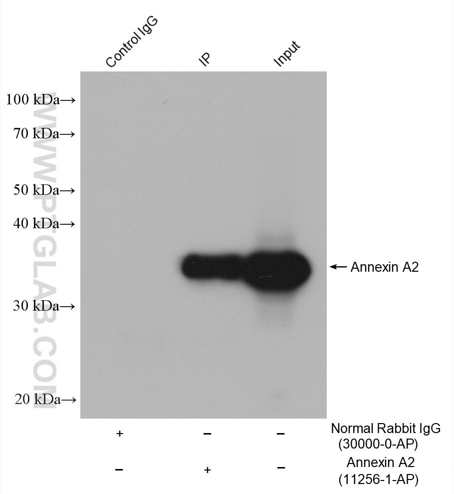 IP-WB detection with RGAR301.
Lysate: HepG2 cells;
IP Primary: Annexin A2, 11256-1-AP;
IP Control: Rabbit IgG, 30000-1-AP;
SDS-PAGE loading amount: 20% of IP elution and 30 μg total protein for input;
WB Primary: Annexin A2, 11256-1-AP, 1:30000;
WB secondary: RGAR301, 1:2500.