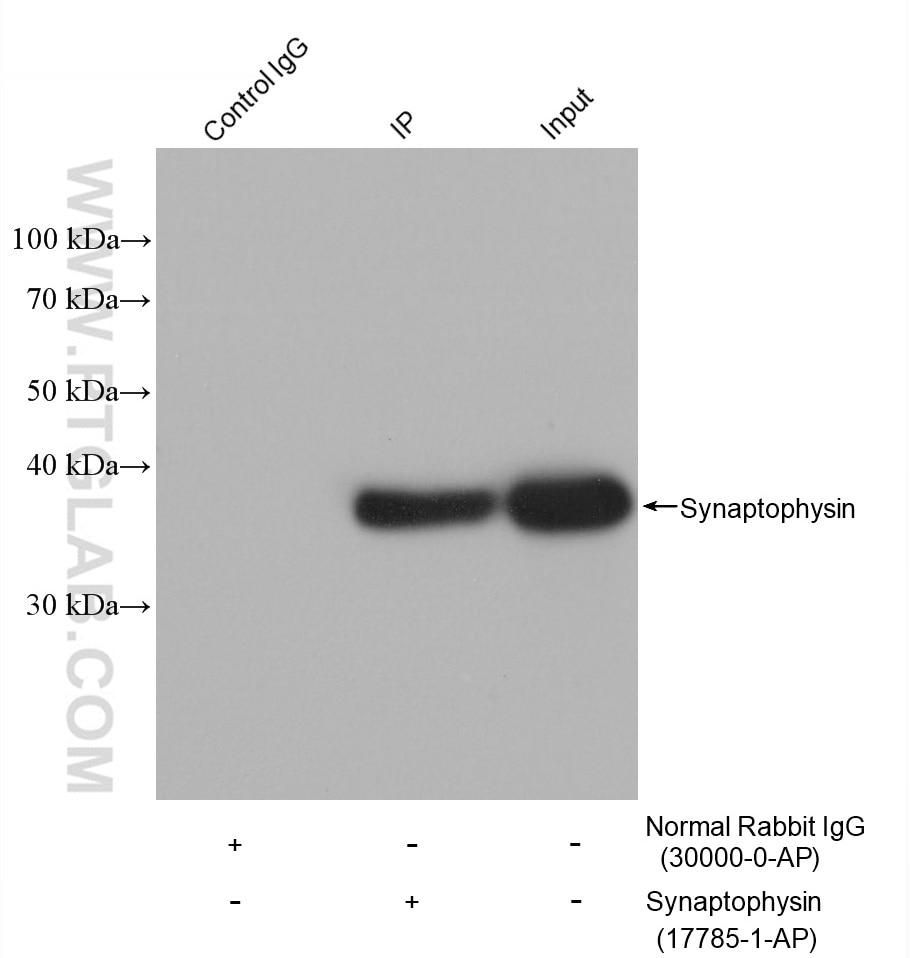 IP-WB detection with RGAR301.
Lysate: Mouse brain tissue;
IP Primary: Synaptophysin, 17785-1-AP;
IP Control: Rabbit IgG, 30000-1-AP;
SDS-PAGE loading amount: 20% of IP elution and 30 μg total protein for input;
WB Primary: Synaptophysin, 17785-1-AP, 1:50000;
WB secondary: RGAR301, 1:2500.