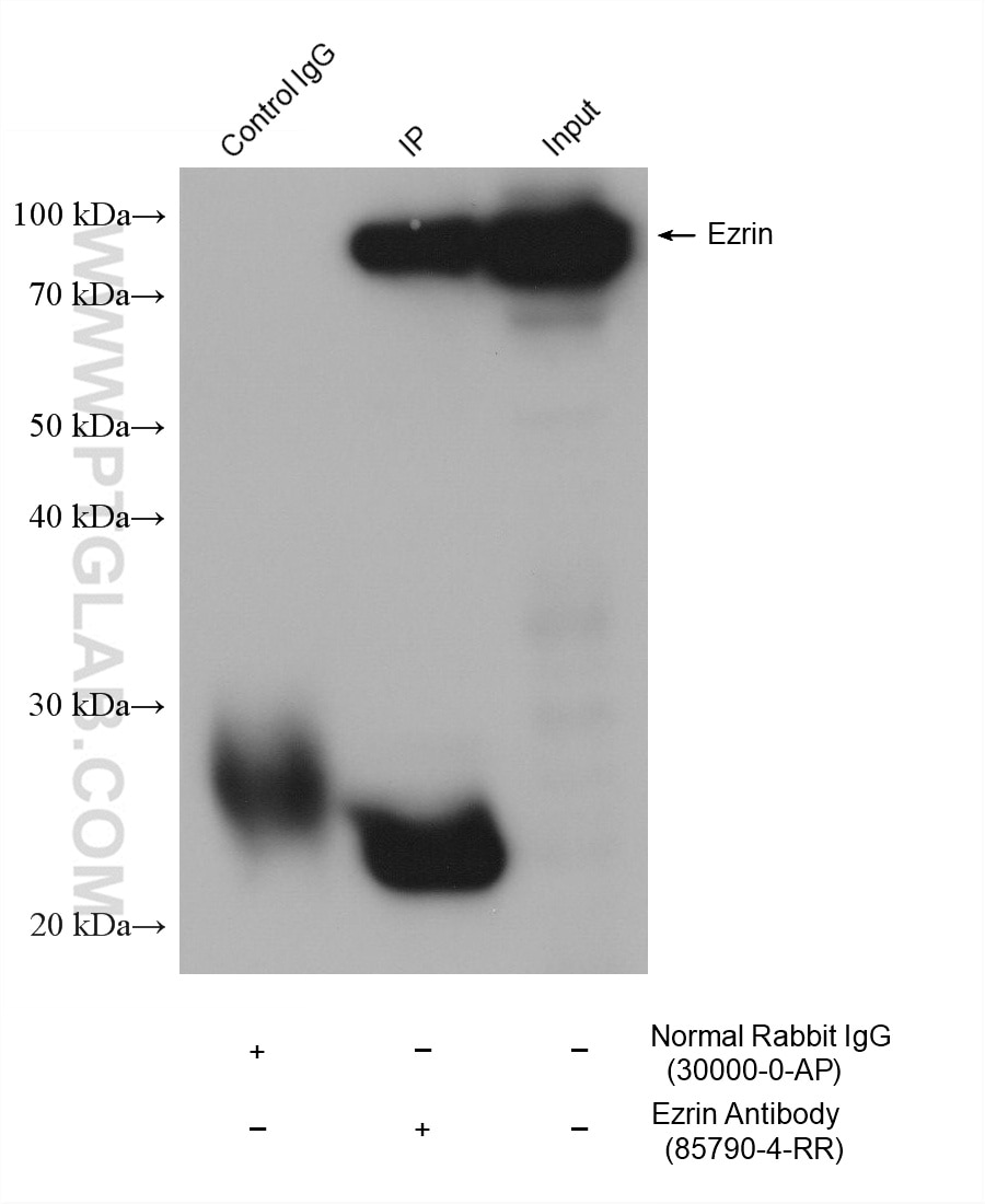 IP-WB detection with RGAR401. Lysate: HeLa cells; IP Primary: Ezrin, 85790-4-RR; IP Control: Rabbit IgG, 30000-1-AP; SDS-PAGE loading amount: 20% of IP elution and 30 μg total protein for input; WB Primary: Ezrin, 85790-4-RR, 1:3000; WB secondary: RGAR401, 1:10000.