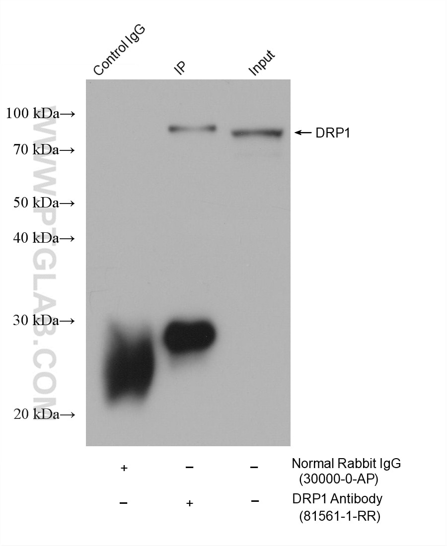 IP-WB detection with RGAR401. Lysate: Rat Brain cells; IP Primary: DRP1, 81561-1-RR; IP Control: Rabbit IgG, 30000-1-AP; SDS-PAGE loading amount: 20% of IP elution and 30 μg total protein for input; WB Primary: DRP1, 81561-1-RR, 1:50000; WB secondary: RGAR401, 1:10000.