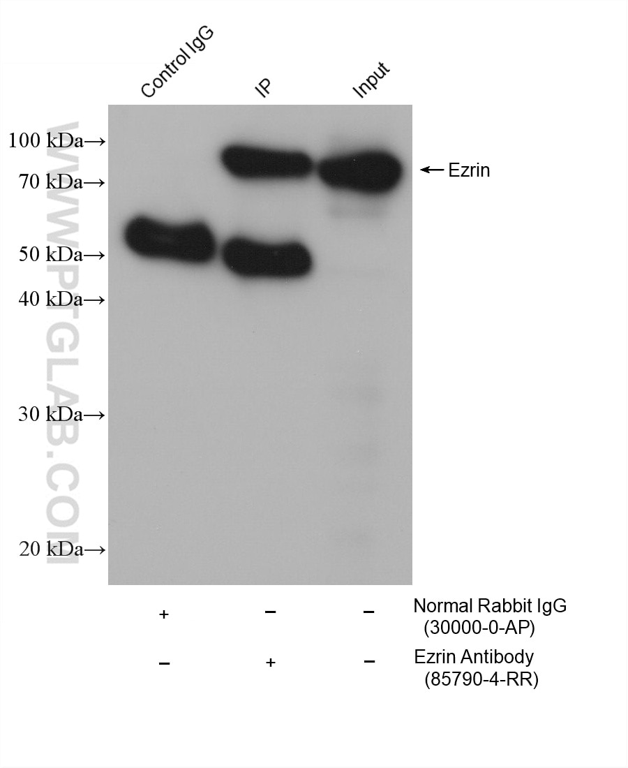 IP-WB detection with RGAR501. Lysate: HeLa cells; IP Primary: Ezrin, 85790-4-RR; IP Control: Rabbit IgG, 30000-1-AP; SDS-PAGE loading amount: 20% of IP elution and 30 μg total protein for input; WB Primary: Ezrin, 85790-4-RR, 1:3000; WB secondary: RGAR501, 1:10000.