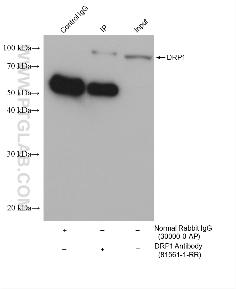IP-WB detection with RGAR501. Lysate: Rat Brain cells; IP Primary: DRP1, 81561-1-RR; IP Control: Rabbit IgG, 30000-1-AP; SDS-PAGE loading amount: 20% of IP elution and 30 μg total protein for input; WB Primary: DRP1, 81561-1-RR, 1:50000; WB secondary: RGAR501, 1:10000.