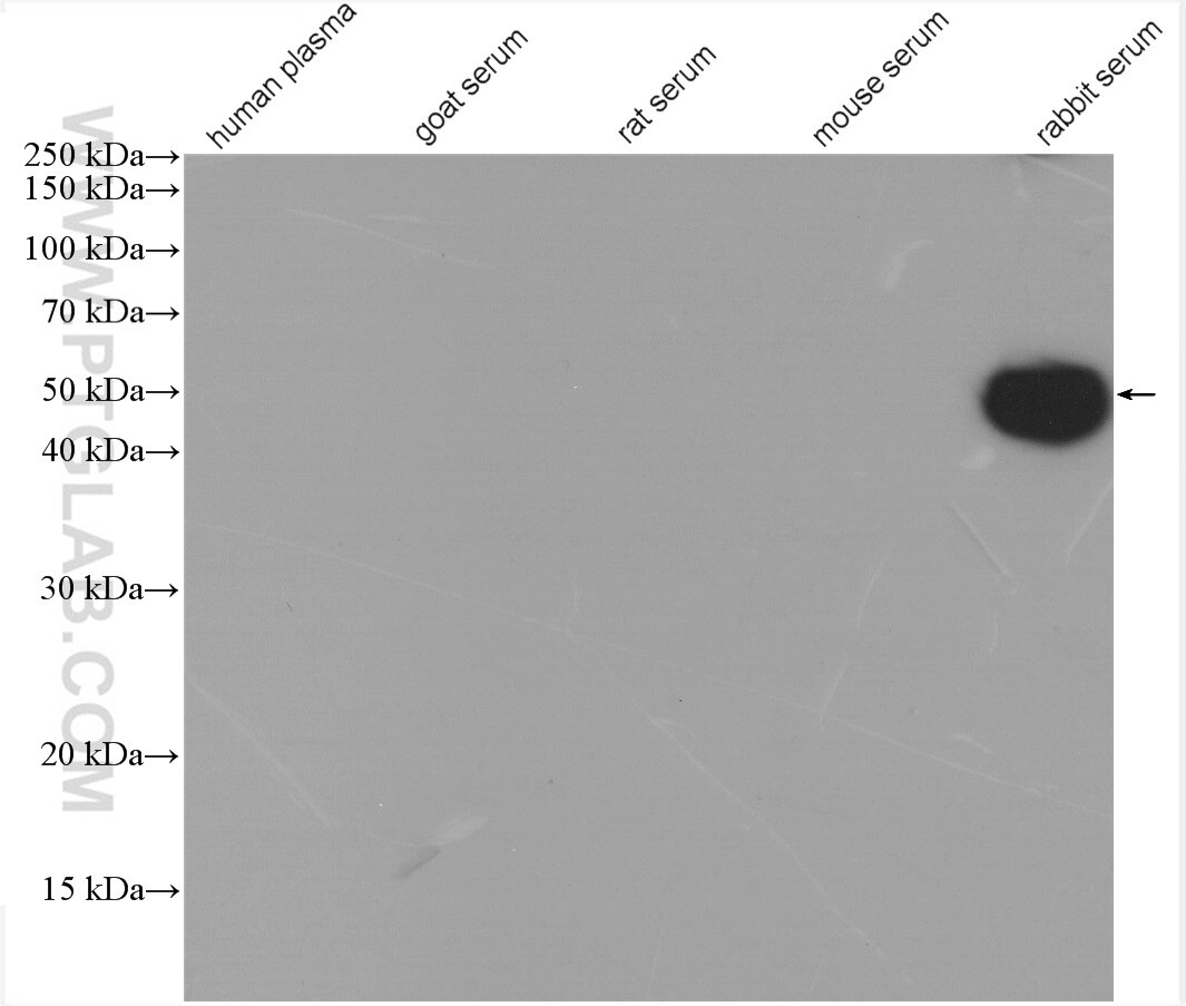 Various serum/plasma lysate were subjected to SDS PAGE followed by western blot with SA00001-7H (HRP-Mouse Anti-Rabbit IgG heavy Chain Specific antibody) at dilution of 1:15000 incubated at room temperature for 1.5 hours.