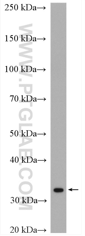 WB analysis of mouse brain using 11042-1-AP