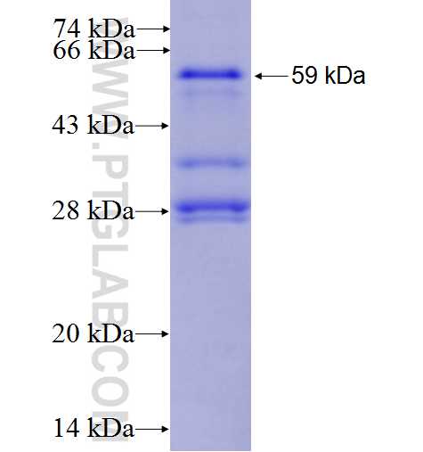 WBP1 fusion protein Ag1478 SDS-PAGE