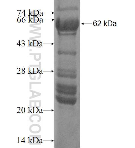 WBP11 fusion protein Ag0366 SDS-PAGE