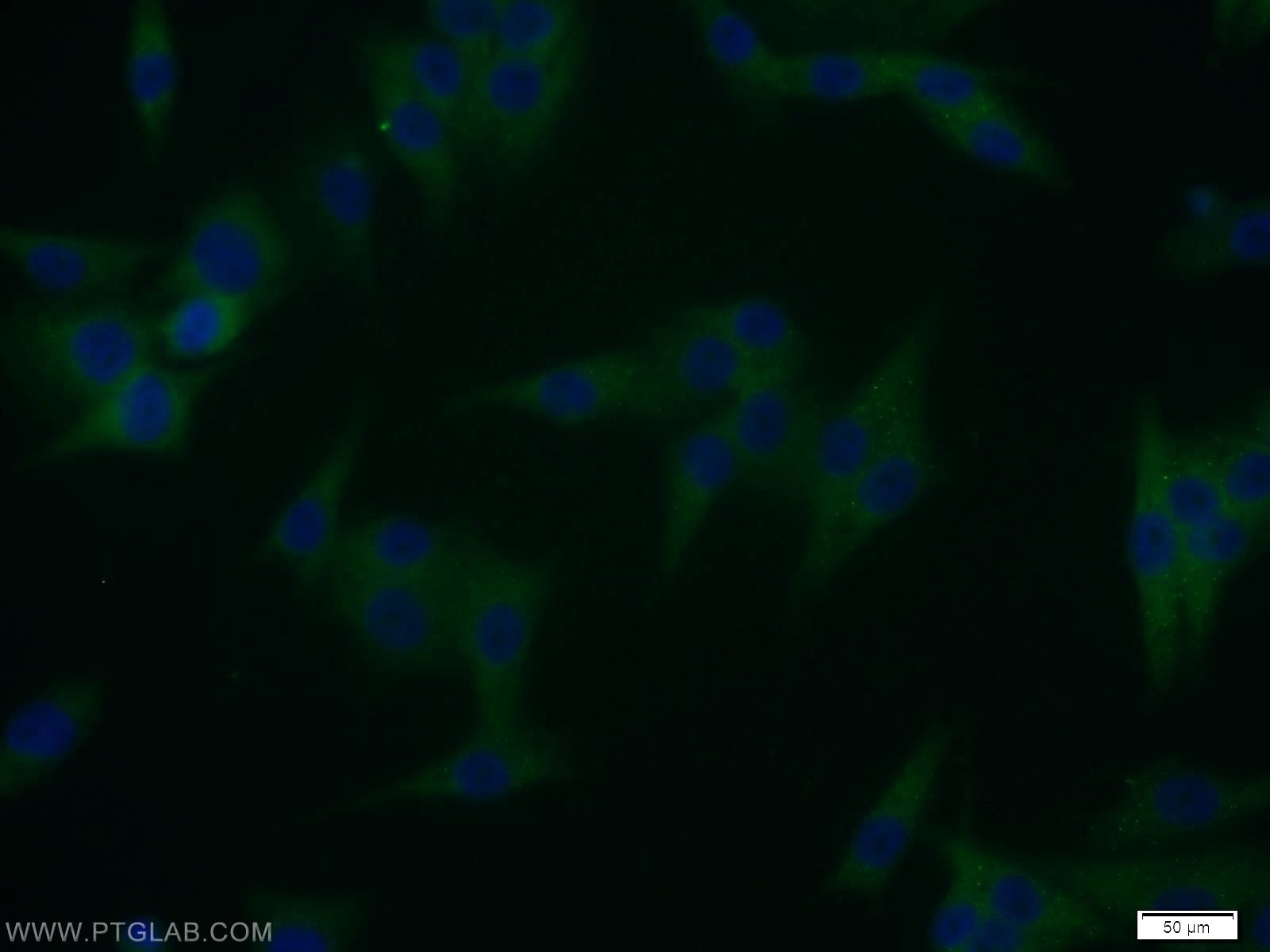 Immunofluorescence (IF) / fluorescent staining of A375 cells using WBP2 Polyclonal antibody (12030-1-AP)