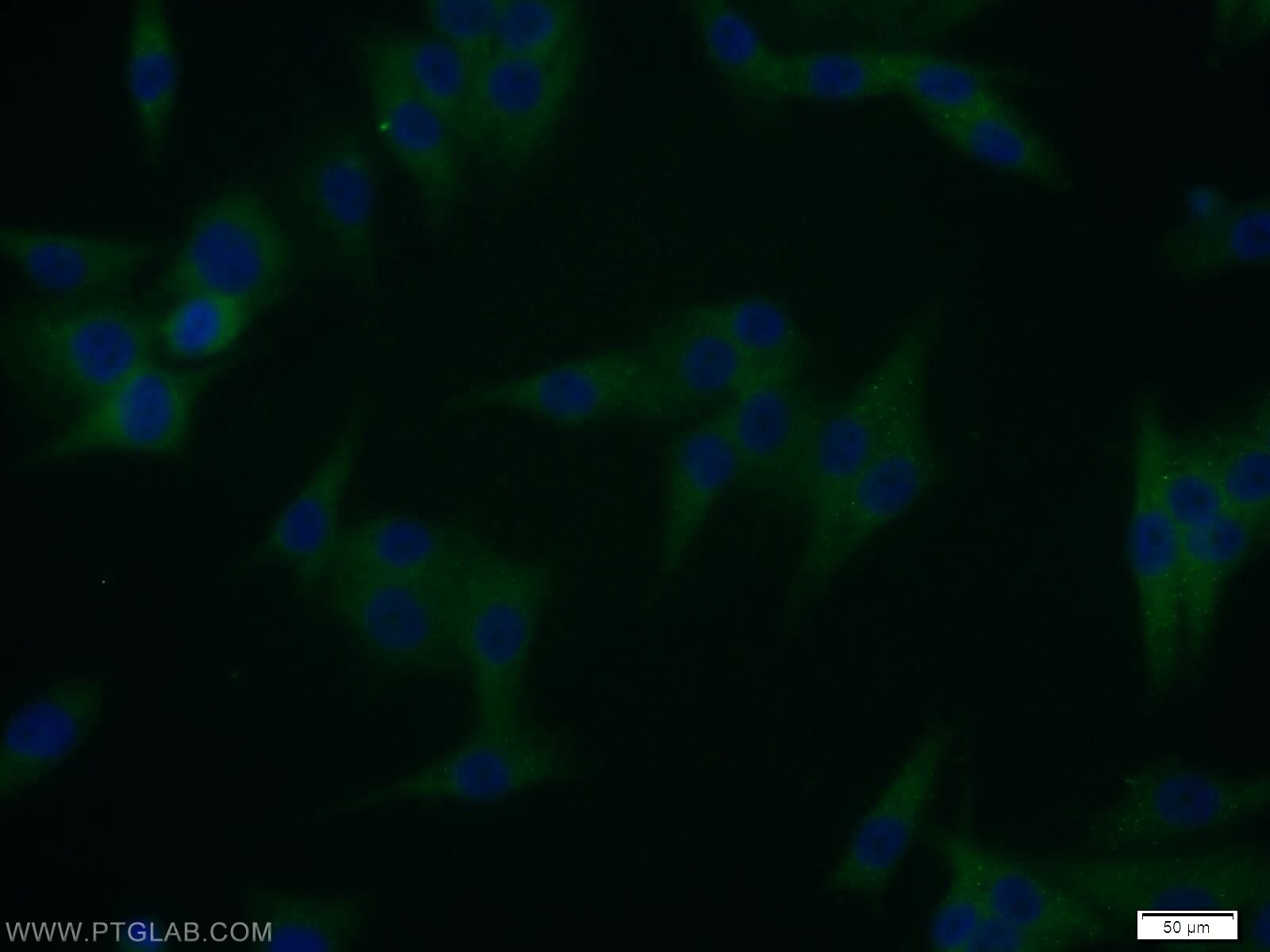 IF Staining of A375 using 12030-1-AP