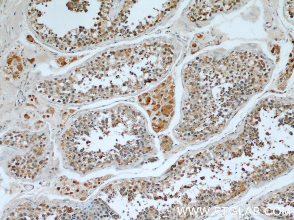 Immunohistochemistry (IHC) staining of human testis tissue using WBP2 Polyclonal antibody (12030-1-AP)