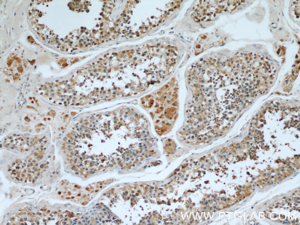 IHC staining of human testis using 12030-1-AP