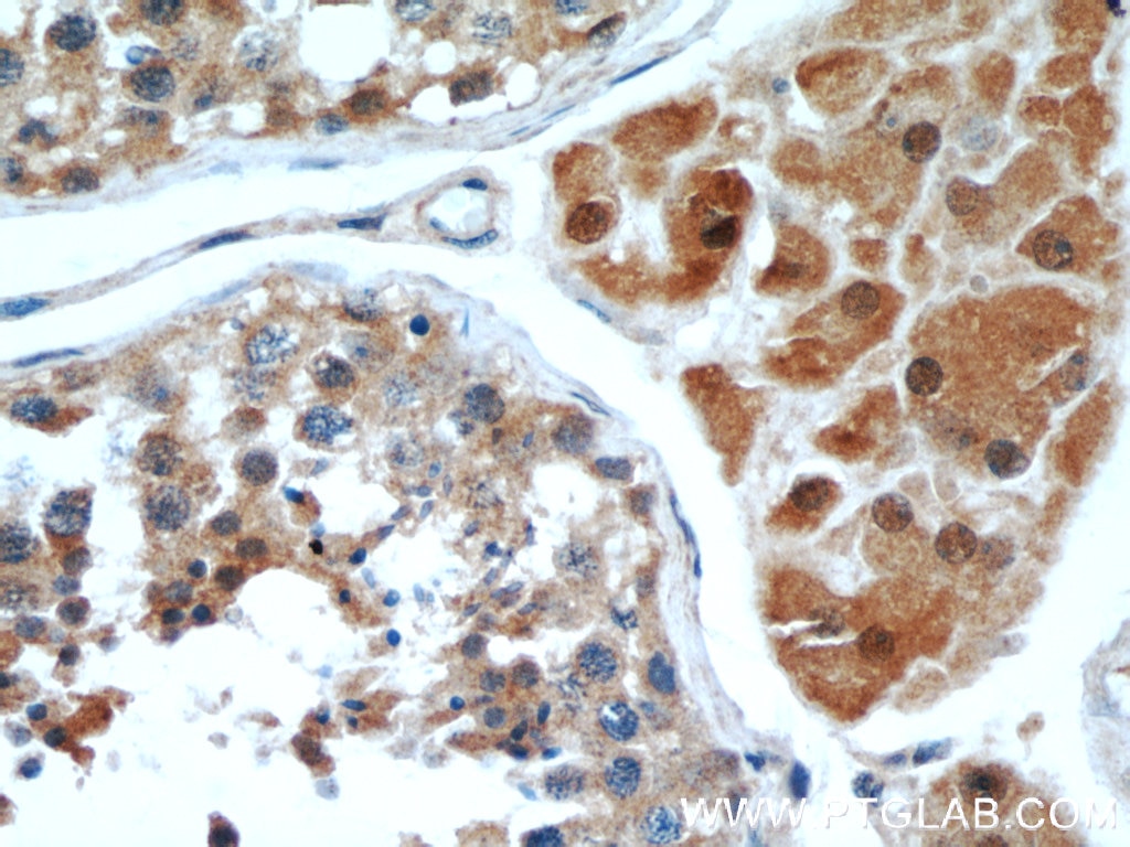 Immunohistochemistry (IHC) staining of human testis tissue using WBP2 Polyclonal antibody (12030-1-AP)