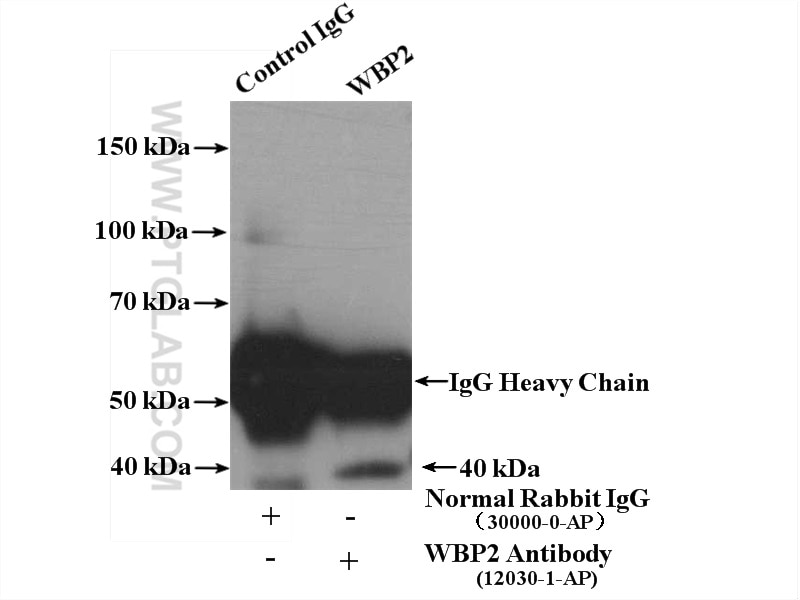 Immunoprecipitation (IP) experiment of A375 cells using WBP2 Polyclonal antibody (12030-1-AP)