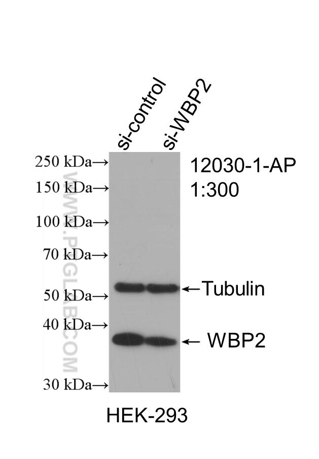 Western Blot (WB) analysis of HEK-293 cells using WBP2 Polyclonal antibody (12030-1-AP)