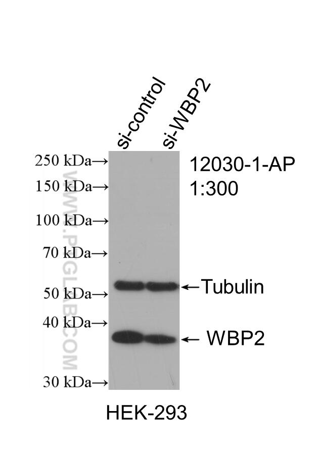 WB analysis of HEK-293 using 12030-1-AP