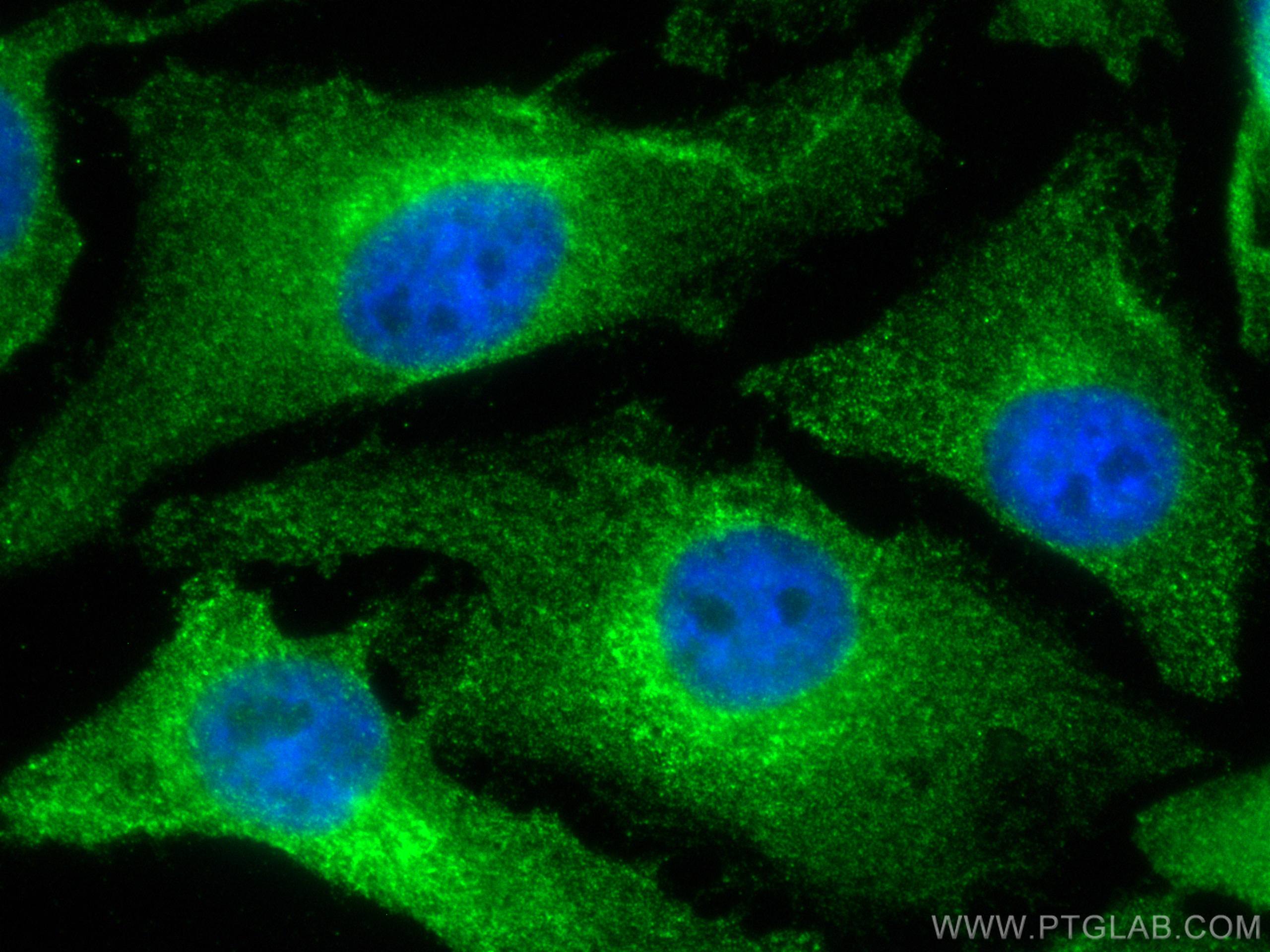 Immunofluorescence (IF) / fluorescent staining of HeLa cells using WBP2 Monoclonal antibody (66585-1-Ig)