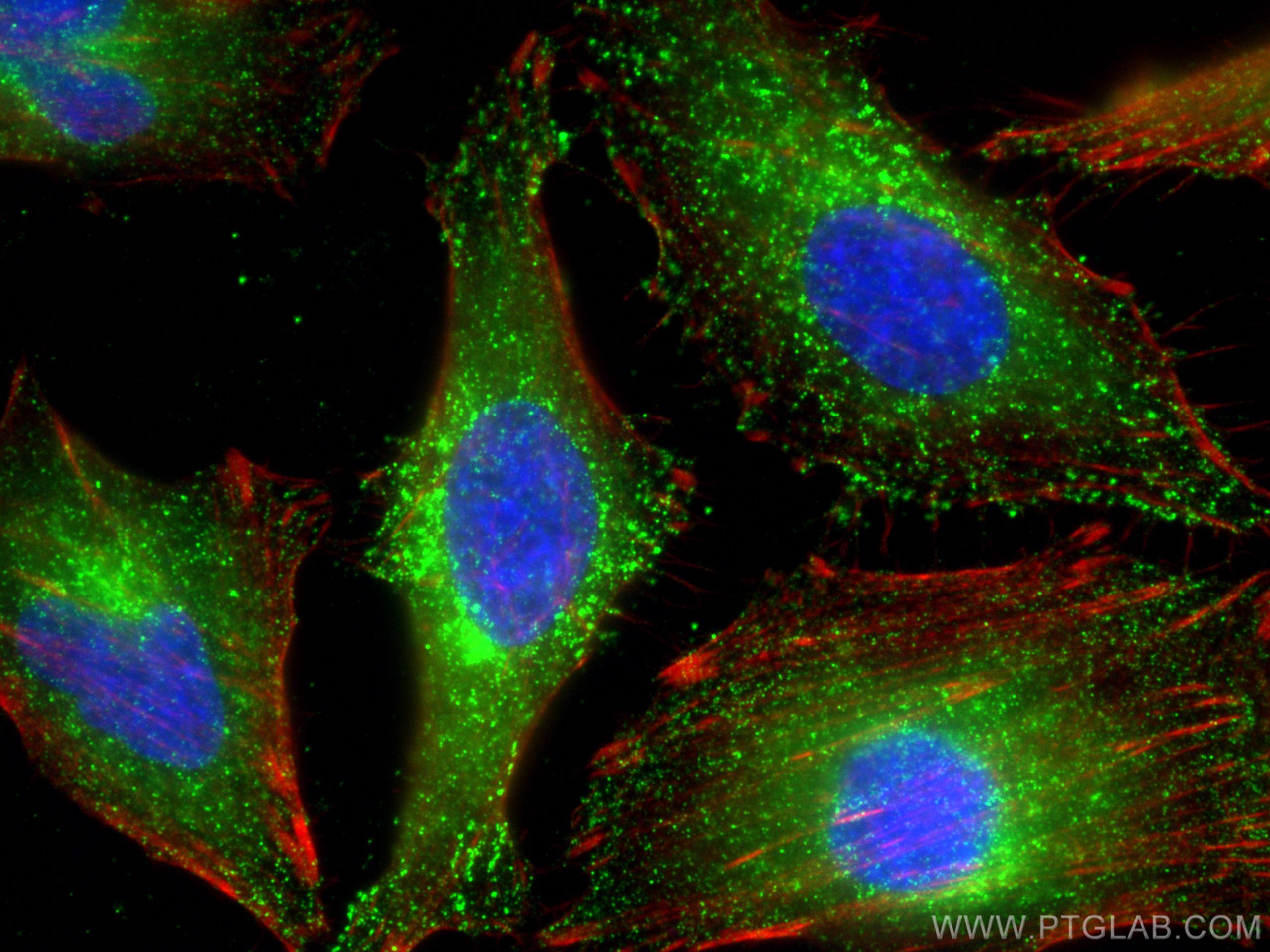 Immunofluorescence (IF) / fluorescent staining of HeLa cells using WBP2 Monoclonal antibody (66585-1-Ig)