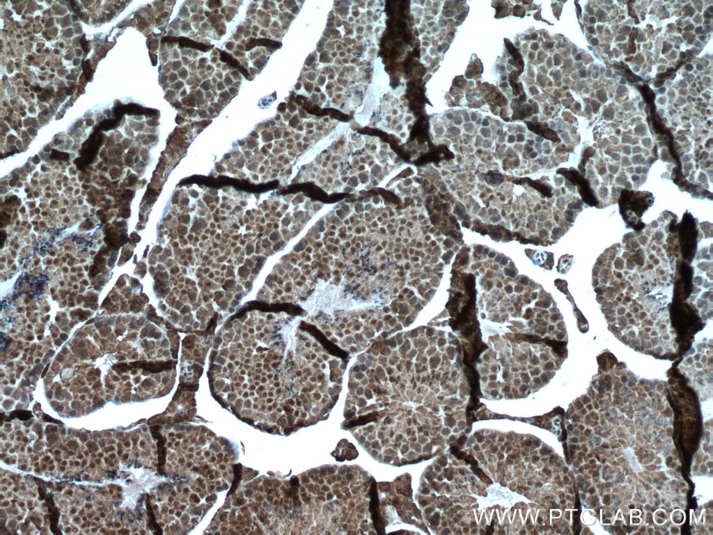 Immunohistochemistry (IHC) staining of mouse testis tissue using WBP2 Monoclonal antibody (66585-1-Ig)