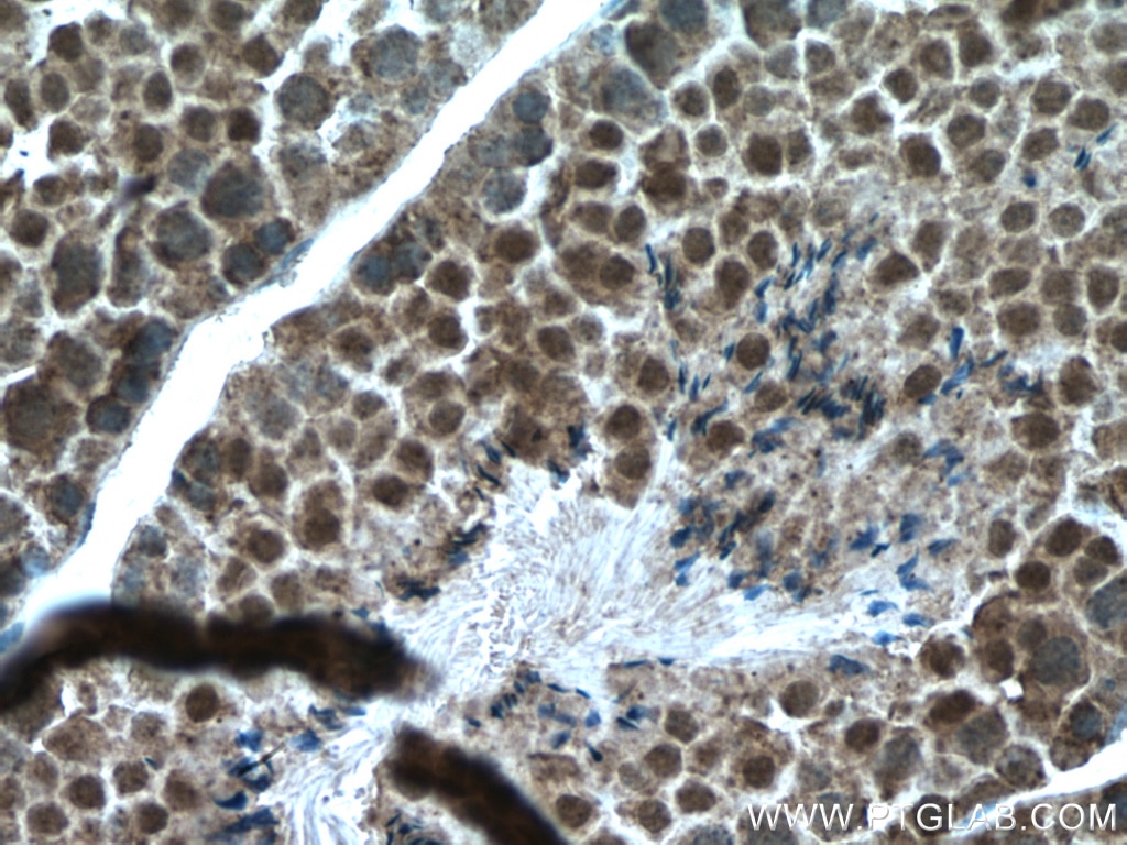 Immunohistochemistry (IHC) staining of mouse testis tissue using WBP2 Monoclonal antibody (66585-1-Ig)