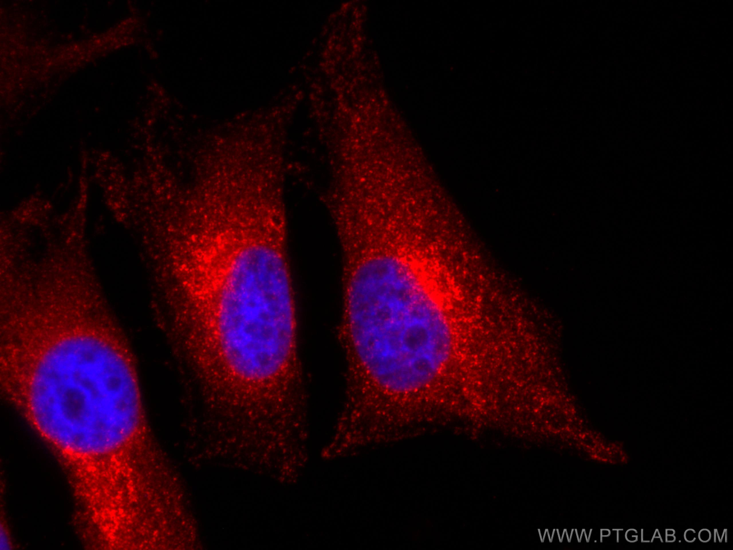 Immunofluorescence (IF) / fluorescent staining of HeLa cells using CoraLite®594-conjugated WBP2 Monoclonal antibody (CL594-66585)