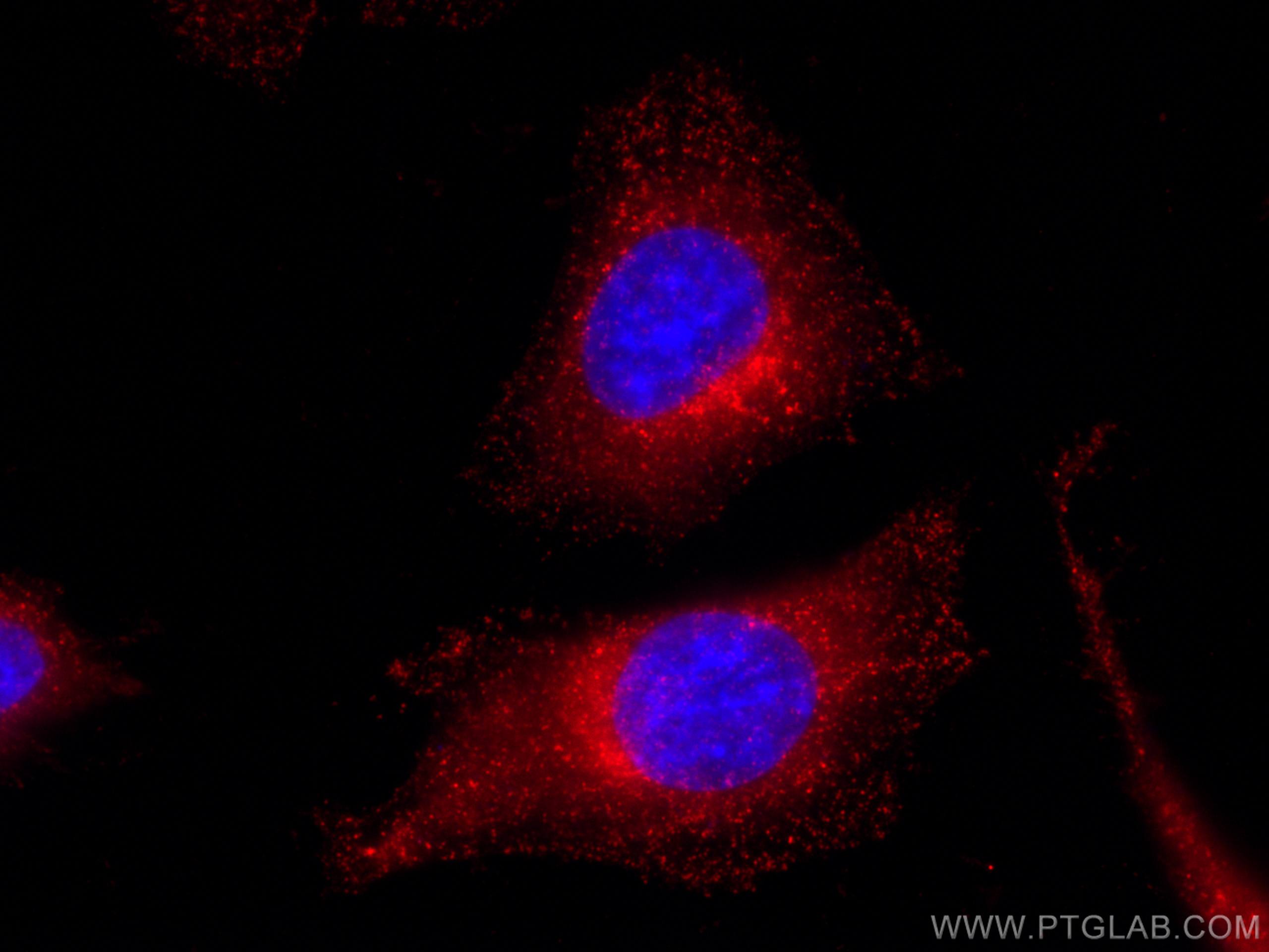 Immunofluorescence (IF) / fluorescent staining of HeLa cells using CoraLite®594-conjugated WBP2 Monoclonal antibody (CL594-66585)